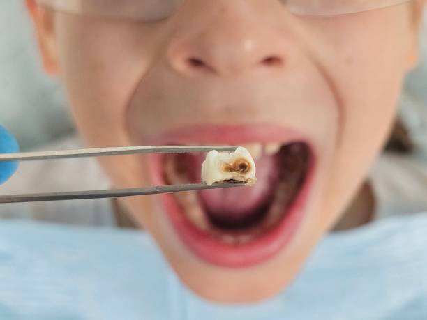 Best Emergency Tooth Extraction  in Rittman, OH